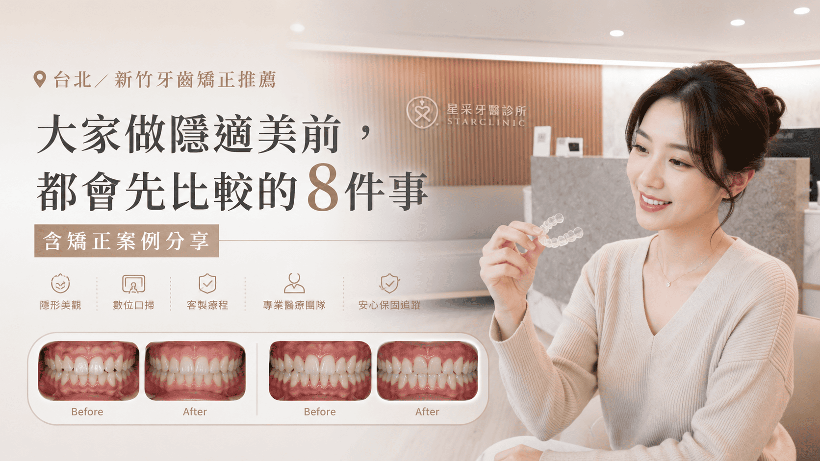 台北／新竹牙齒矯正推薦(含矯正案例)：大家做隱適美前，都會先比較的8件事